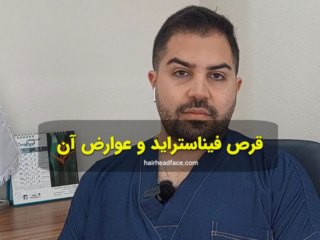 قرص فیناستراید و عوارض آن