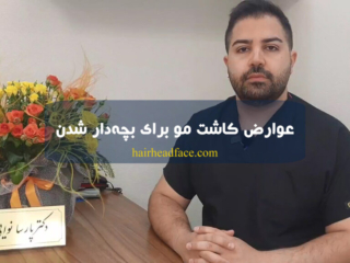 عوارض کاشت مو طبیعی برای بچه دار شدن
