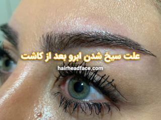 علت سیخ شدن ابرو بعد از کاشت