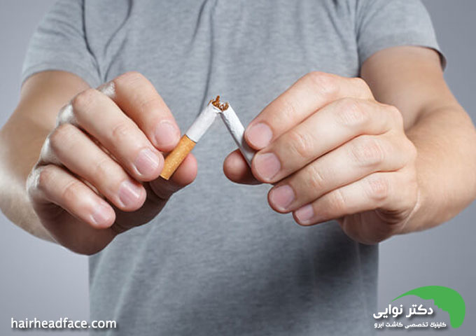 سیگار کشیدن قبل از کاشت مو 