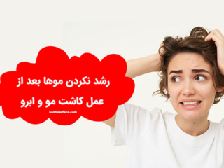 رشد نکردن موهای کاشته شده بعد از عمل کاشت مو کاشت ابرو