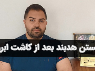 بستن هدبند بعد از کاشت ابرو