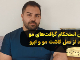 زمان استحکام گرافت های مو بعد از عمل کاشت مو و ابرو