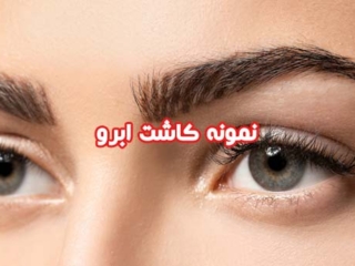 بهترین کلینیک کاشت ابرو طبیعی در اصفهان