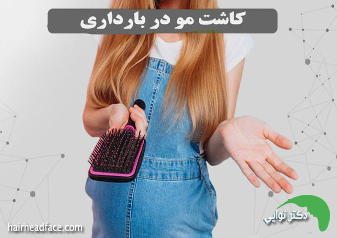 کاشت مو در بارداری نی نی سایت 