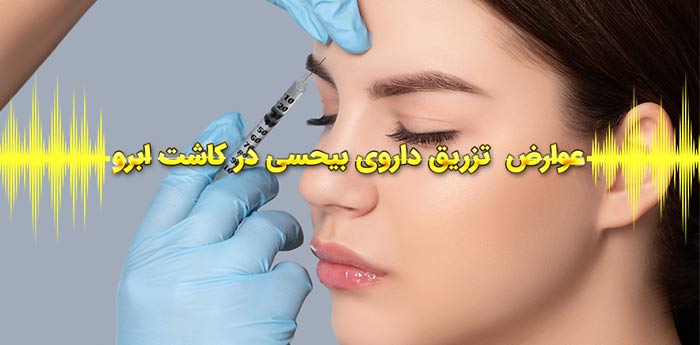 عوارض تزریق داروی بیحسی در کاشت ابرو