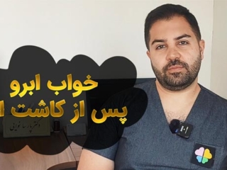 حالت دهی یا خواب ابرو پس از کاشت ابرو