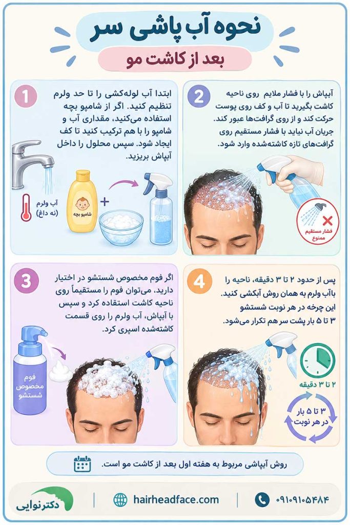 آب پاشی سر بعد از کاشت مو