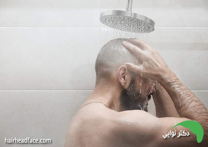 کارهای ممنوعه در شب اول کاشت مو 