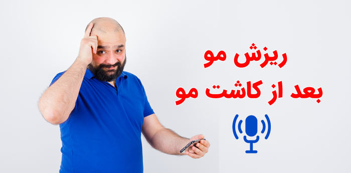 چرا بعضی ها بعد از کاشت مو دوباره ریزش مو دارند