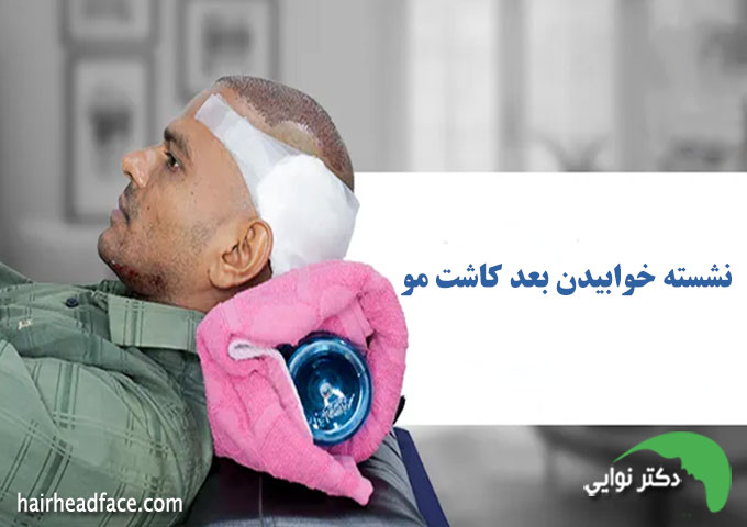 علت نشسته خوابیدن بعد از کاشت مو