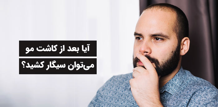 سیگار کشیدن بعد از کاشت مو