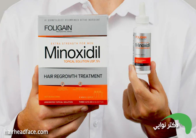 عوارض ماینوکسیدیل در دراز مدت