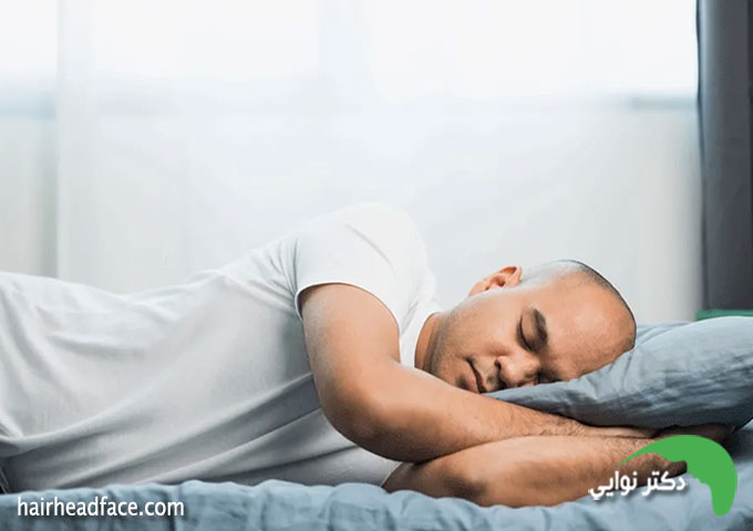 مدت زمان ممنوعیت خوابیدن به پهلو بعد از کاشت مو