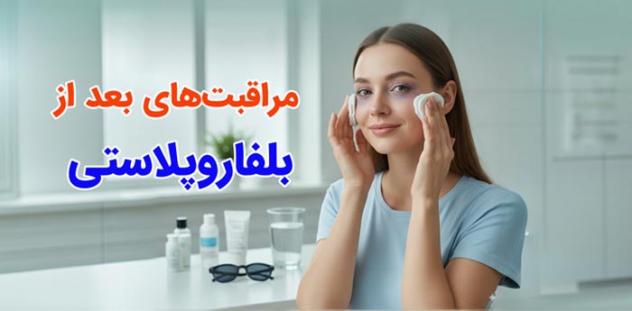 مراقبت های بعد از عمل بلفاروپلاستی (جراحی پلک)
