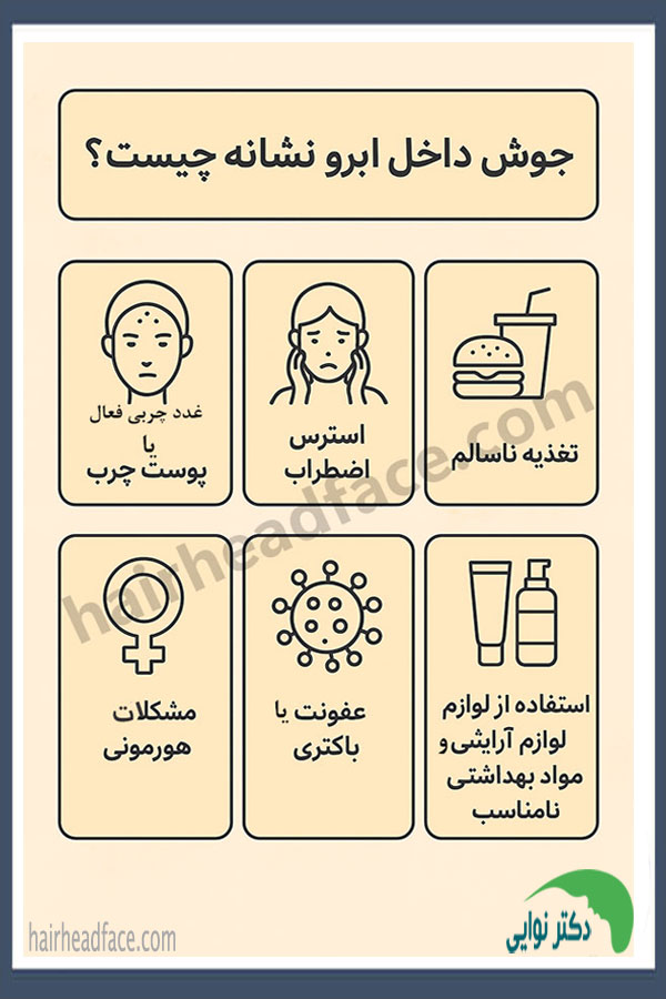 جوش داخل ابرو نشانه چیست