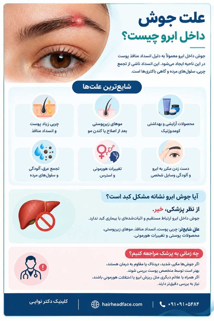 علت جوش داخل ابرو
