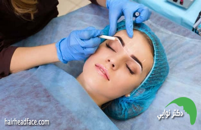 کاشت ابرو برای افراد دیابتی