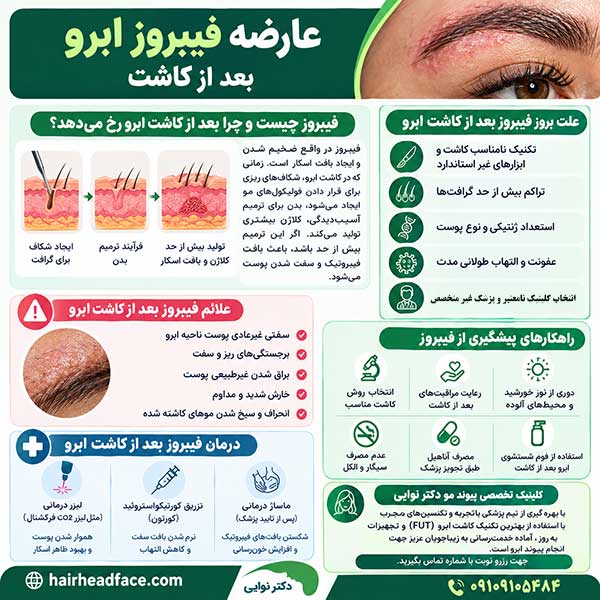 فیبروز بعد از کاشت ابرو 
