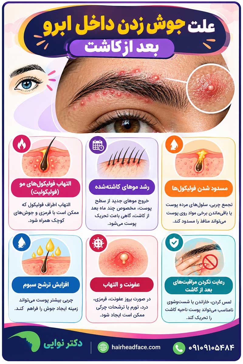 علت جوش زدن داخل ابرو بعد از کاشت