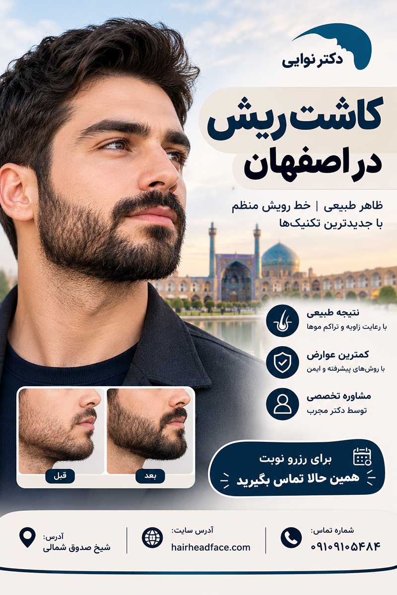 کاشت ریش در اصفهان