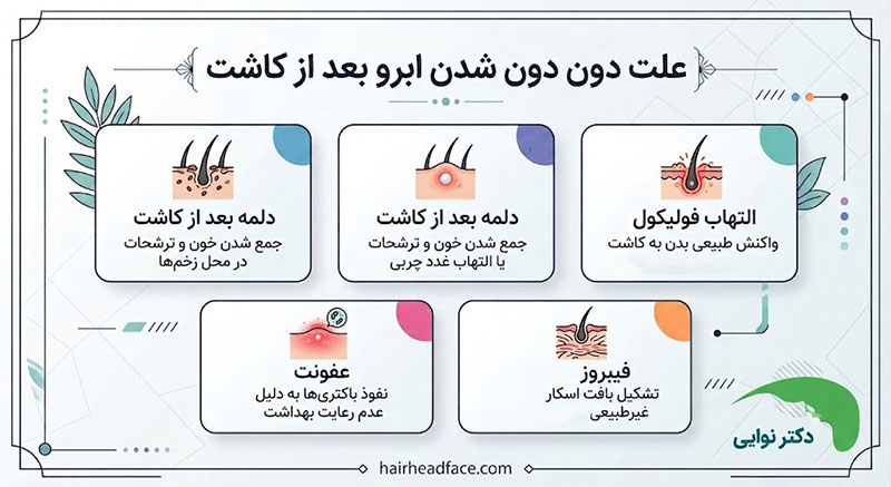 علت دون دون شدن ابرو بعد از کاشت 