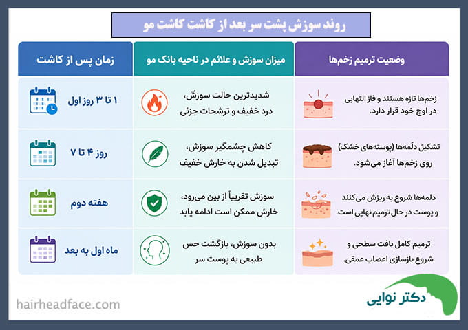 سوزش پشت سر بعد از کاشت مو چند روز طول میکشد