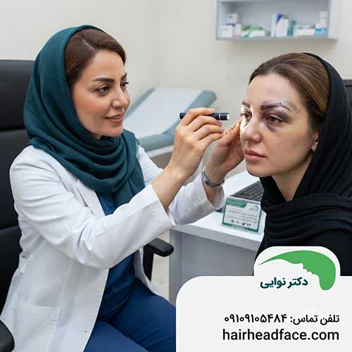 علت کبودی بعد از کاشت ابرو 