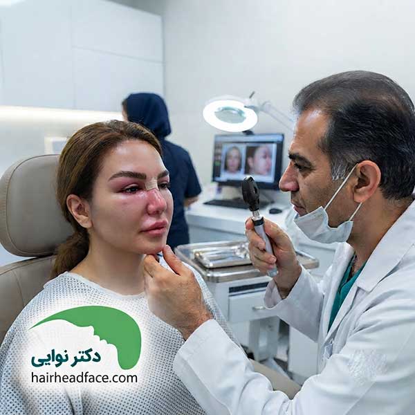 ورم چشم بعد از کاشت ابرو 
