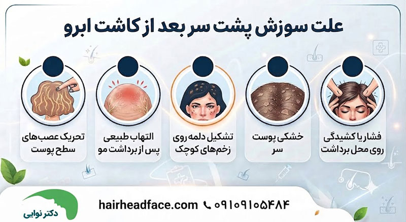 علت سوزش پشت سر بعد از کاشت ابرو