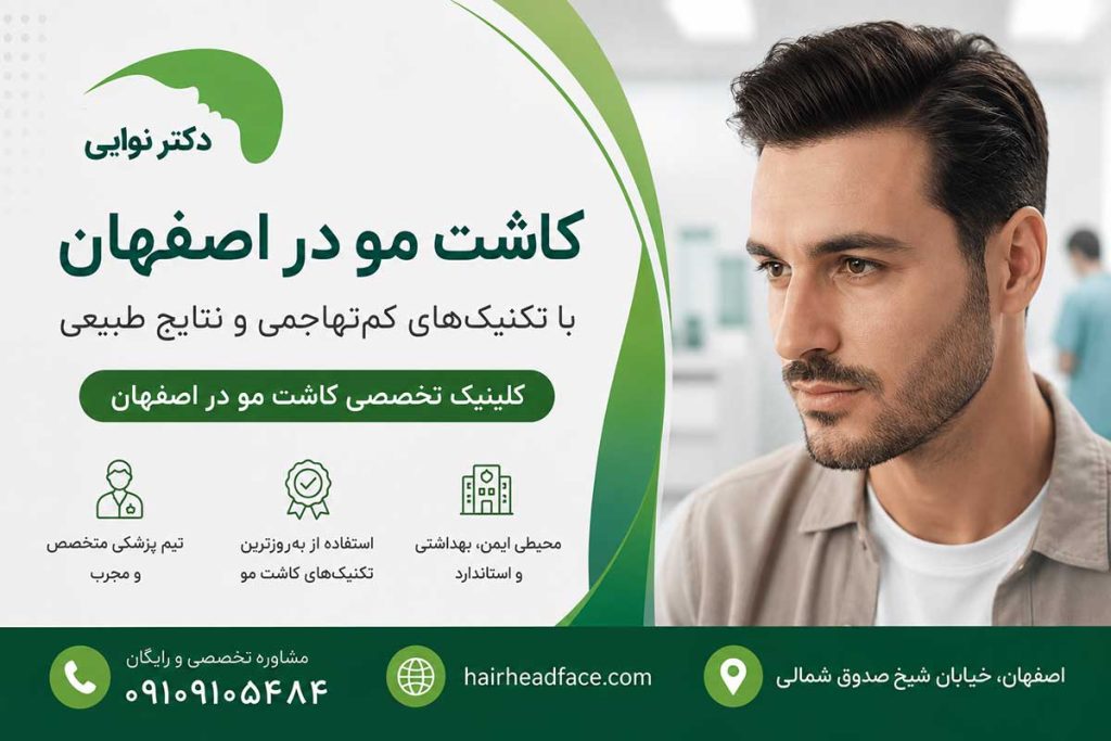 کاشت مو در اصفهان