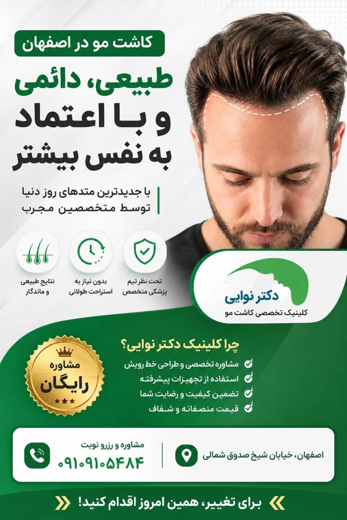 هزینه کاشت مو در اصفهان