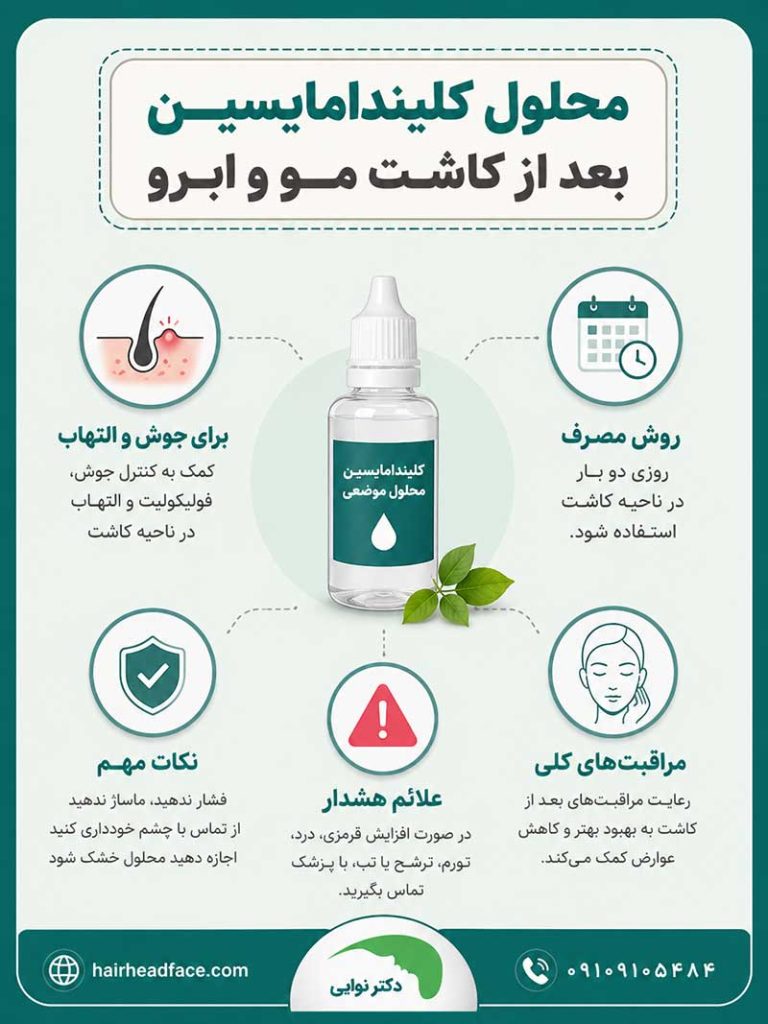 محلول کلیندامایسین بعد از کاشت مو 