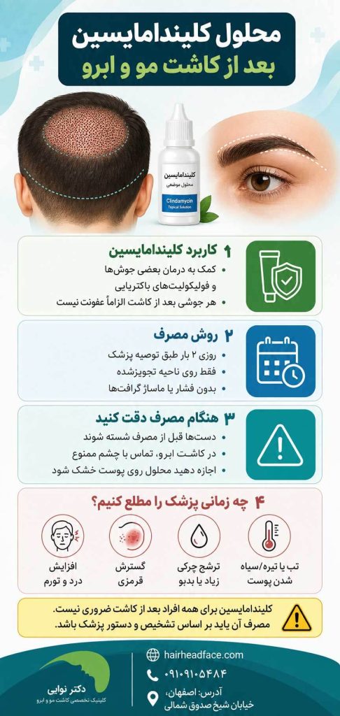 محلول کلیندامایسین بعد از کاشت