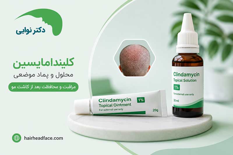 پماد کلیندامایسین بعد از کاشت مو 