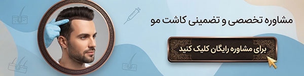 مشاوره کاشت مو 