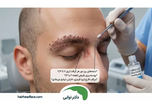 باورهای غلط رایج درباره آب پاشی بعد از کاشت ابرو 