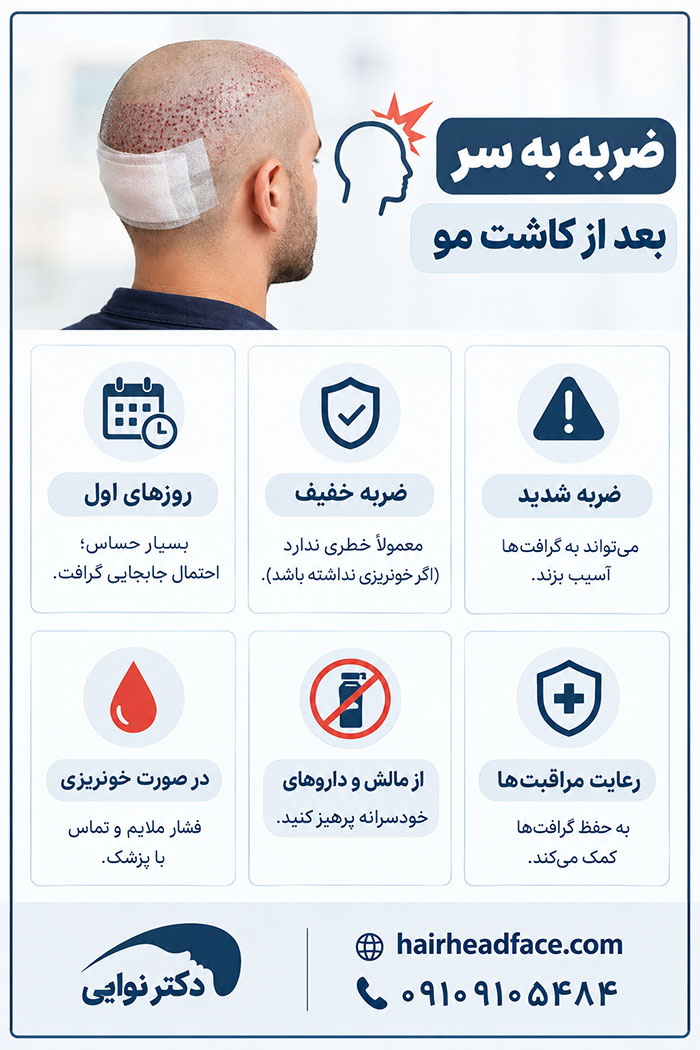 ضربه خفیف به سر