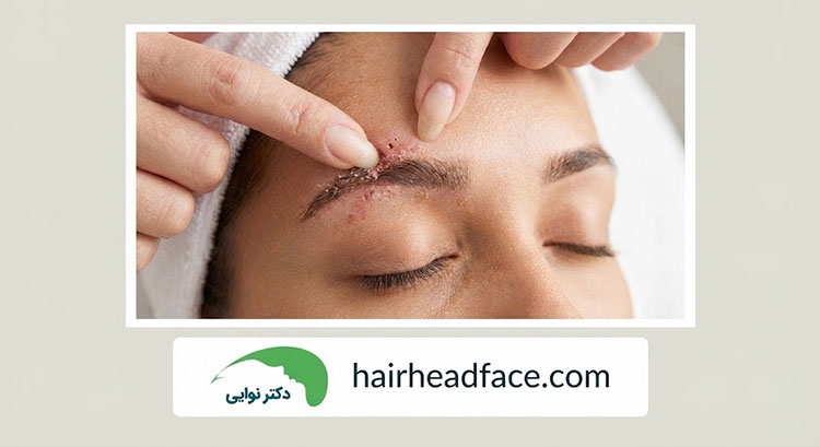 اشتباهات رایج در ماساژ ابرو