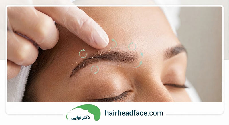 ماساژ ابرو بعد از کاشت از چه روزی شروع میشود؟