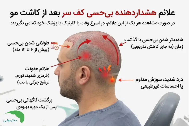 علائم هشداردهنده بیحسی کف سر بعد کاشت